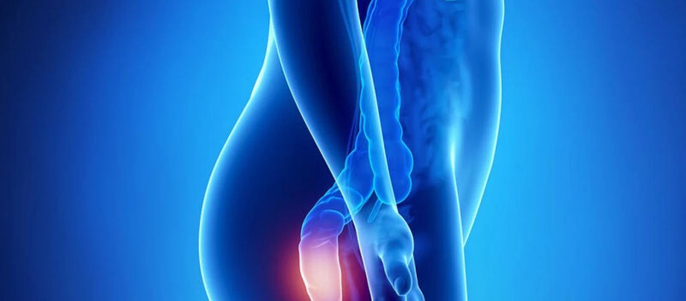 Αιμορροΐδες: Τι ρόλο παίζει η κληρονομικότητα στην αιμορροΐδοπάθεια;